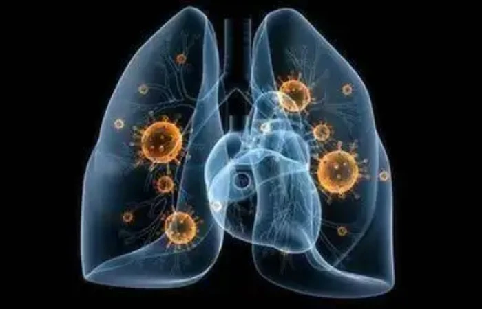 Bioglutide NA-931 Cardiovascular Health Improvements | Shaanxi BLOOM Tech Co., Ltd Bioglutide NA-931 Cardiovascular Health Improvements | Shaanxi BLOOM Tech Co., Ltd