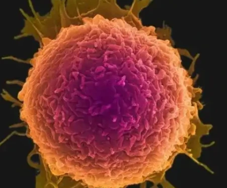 Artesunate tumor cells | Shaanxi BLOOM Tech Co., Ltd Artesunate tumor cells | Shaanxi BLOOM Tech Co., Ltd